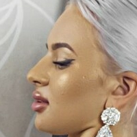Florina Nua