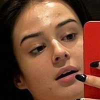 Lauraysergii Nua