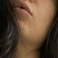 traversetina Nua