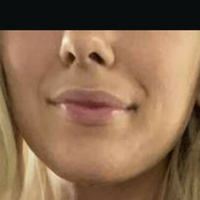 Wettmelons Nua